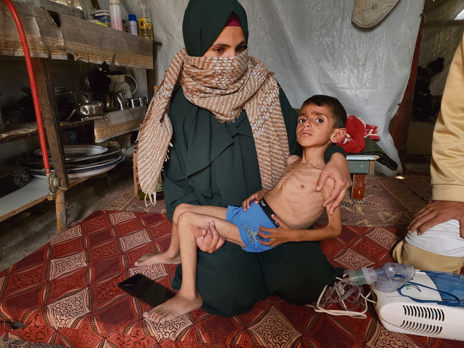Gaza : La famine et le médicide se précisent sous les bombes